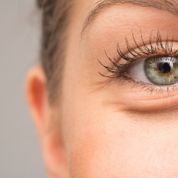 Eyelid surgery (Blepharoplasty) model 02, Dr Peters Brisbane
